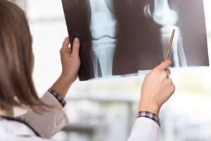 Radiografía. Tres proyecciones de rodilla. Axial (30-60-90) en Sabadell