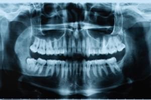 Ortopantomografía Odontología en Madrid