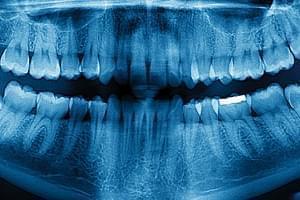 TAC Dental 1 arcada en Madrid