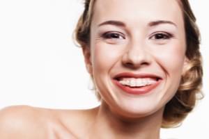 Ortodoncia fija estética de porcelana en Madrid