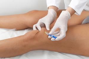 Factores de crecimiento. Plasma enriquecido en plaquetas. Dos sesiones en Barcelona