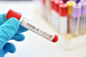 Test de inmunidad coronavirus. Serología IGM, IGG en Granollers